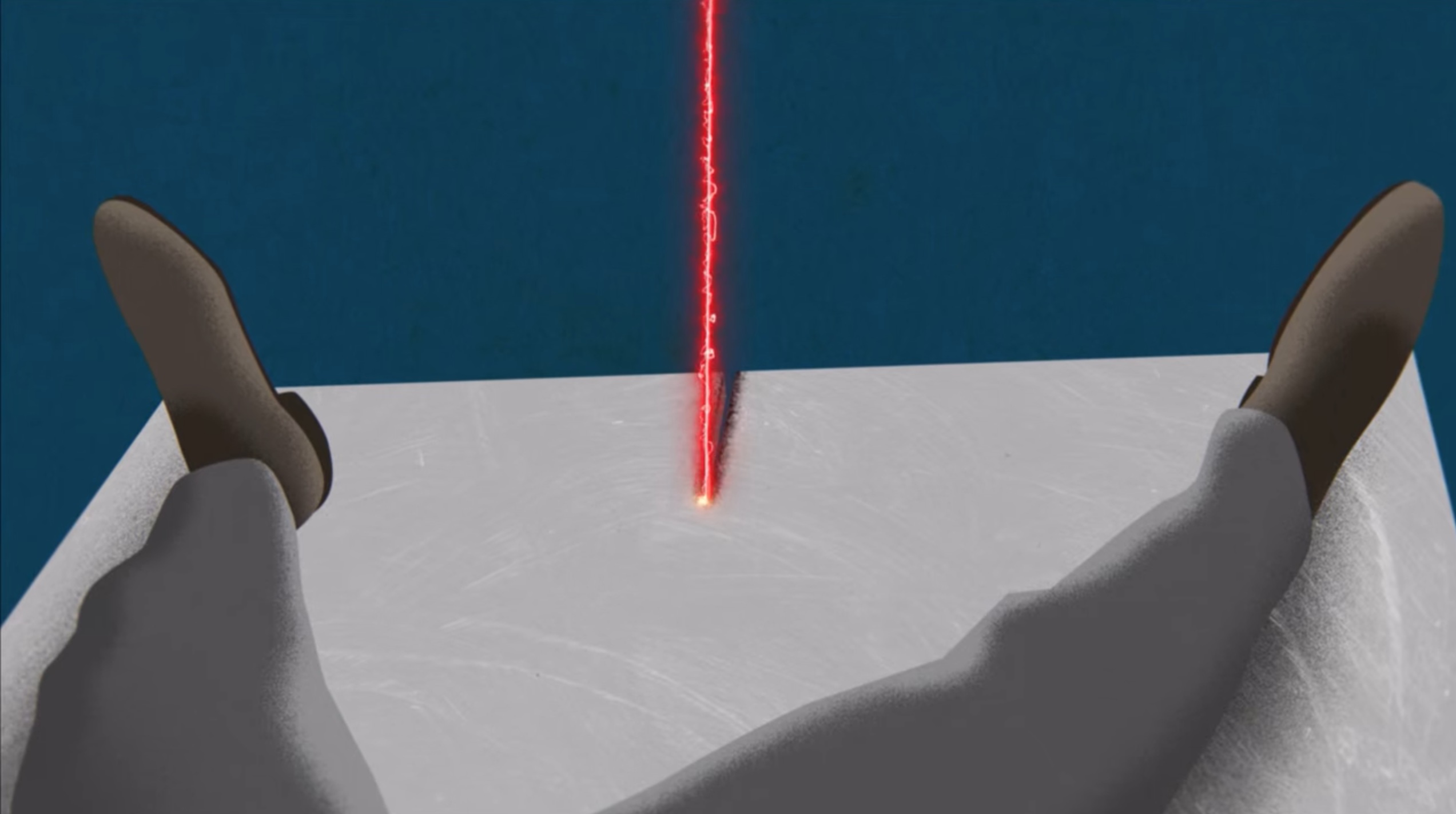 Lasers