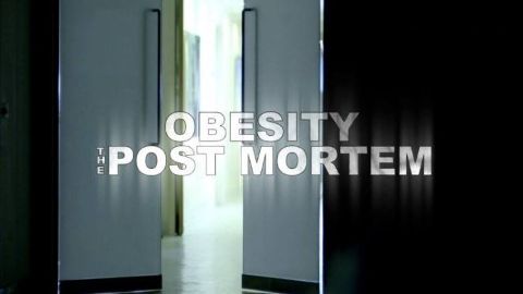 Obesity: The Post Mortem